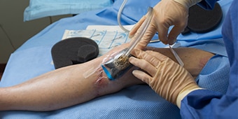 Medical staff treating an infected wound on a patient
